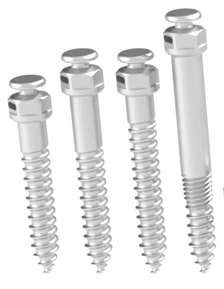 MINIIMPLANTES EXTRAALVEOLARES